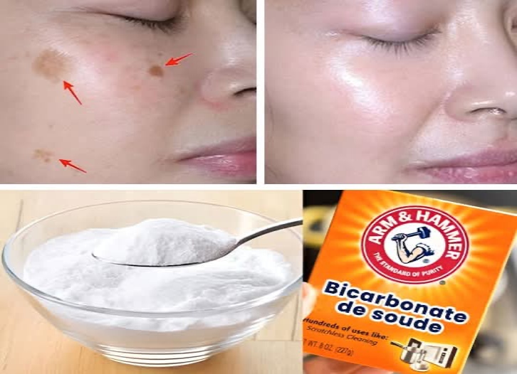 Bicarbonate De Soude Tache Brune Visage Avis 4 façons d’effacer les taches de vieillesse avec du bicarbonate de